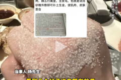 火锅烫手撒白糖？网友亲测有效？医生警告：小心细菌感染，烂得更快！