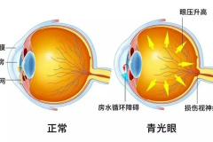 跨越无声与黑暗：永春爱尔眼科助83岁聋哑老人重寻光明