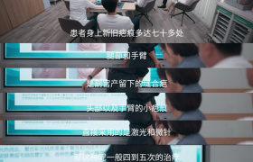 氢气球引发“砰燃”危机！《以美之名》医疗顾问教你保命“秘籍”